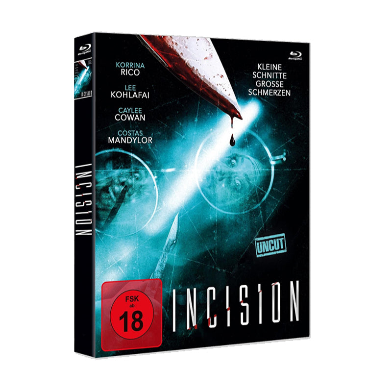 Incision - Wmm Scanavo Box